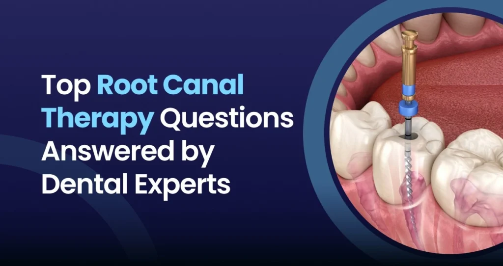 Dental illustration showing a root canal treatment procedure inside an infected tooth