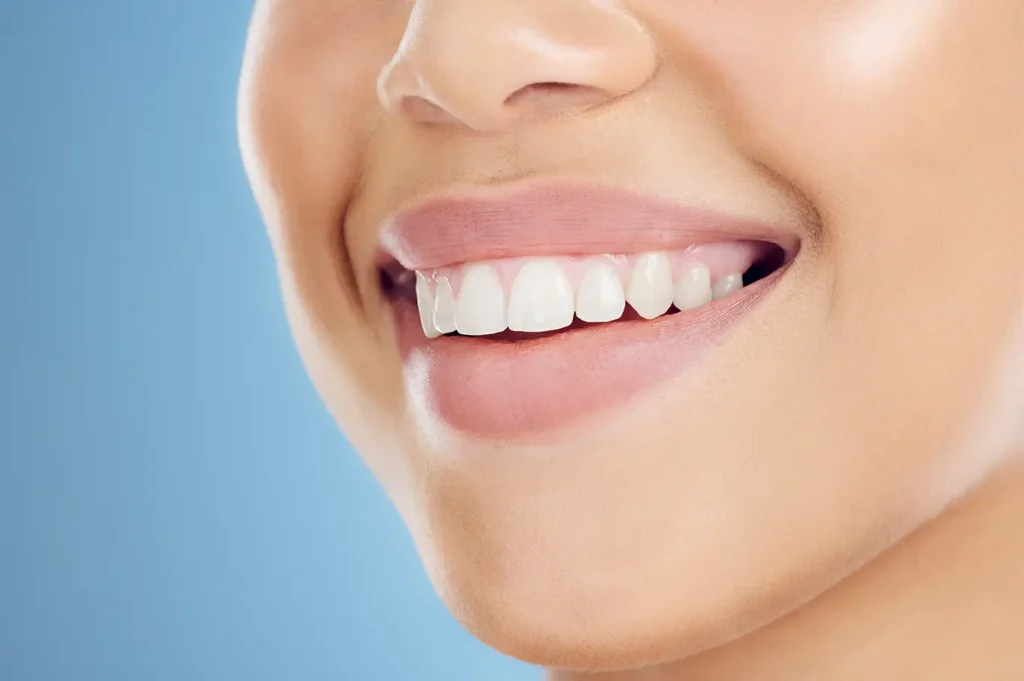 Close-up of a simple smiling mouth showing white teeth, illustrating tips to maintain teeth whiteness after whitening treatment