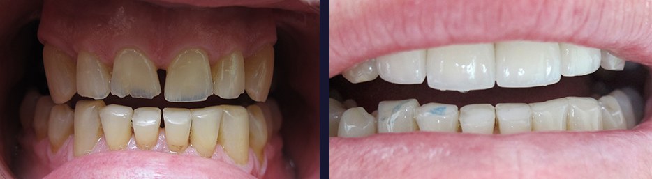 case4.jpg