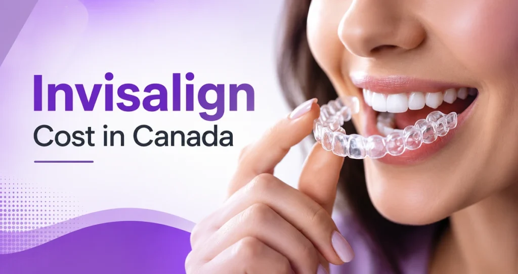 Invisalign cost in Canada