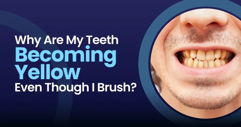 Yellow teeth despite regular brushing