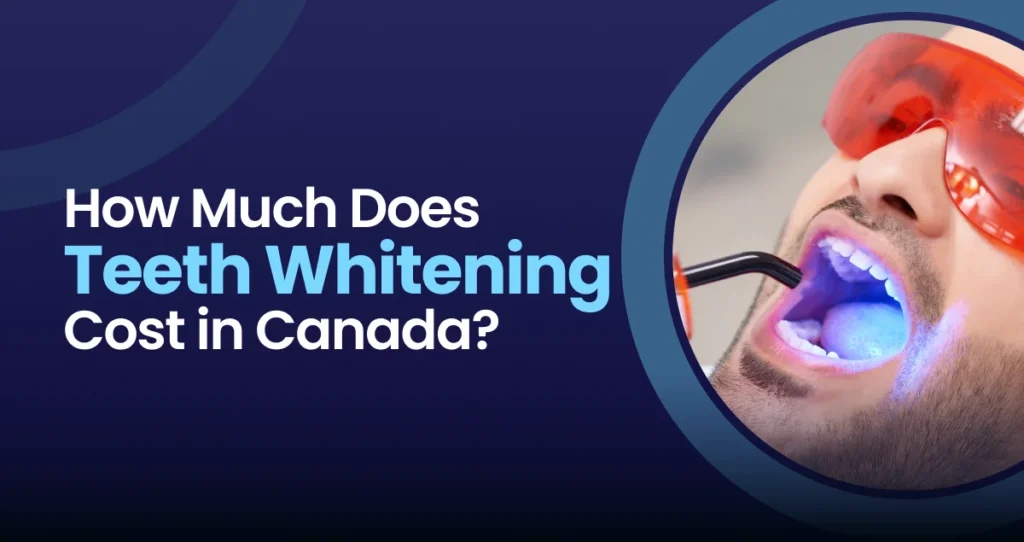 Teeth Whitening Cost in Canada
