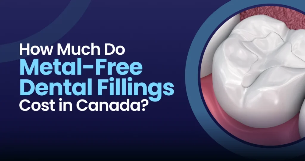 Metal-Free Dental Fillings Cost in Canada